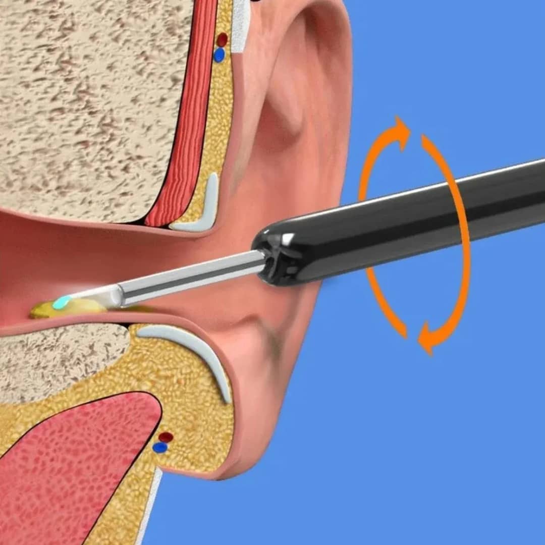 Nettoyeur D'otoscope Vidéo 3 En 1